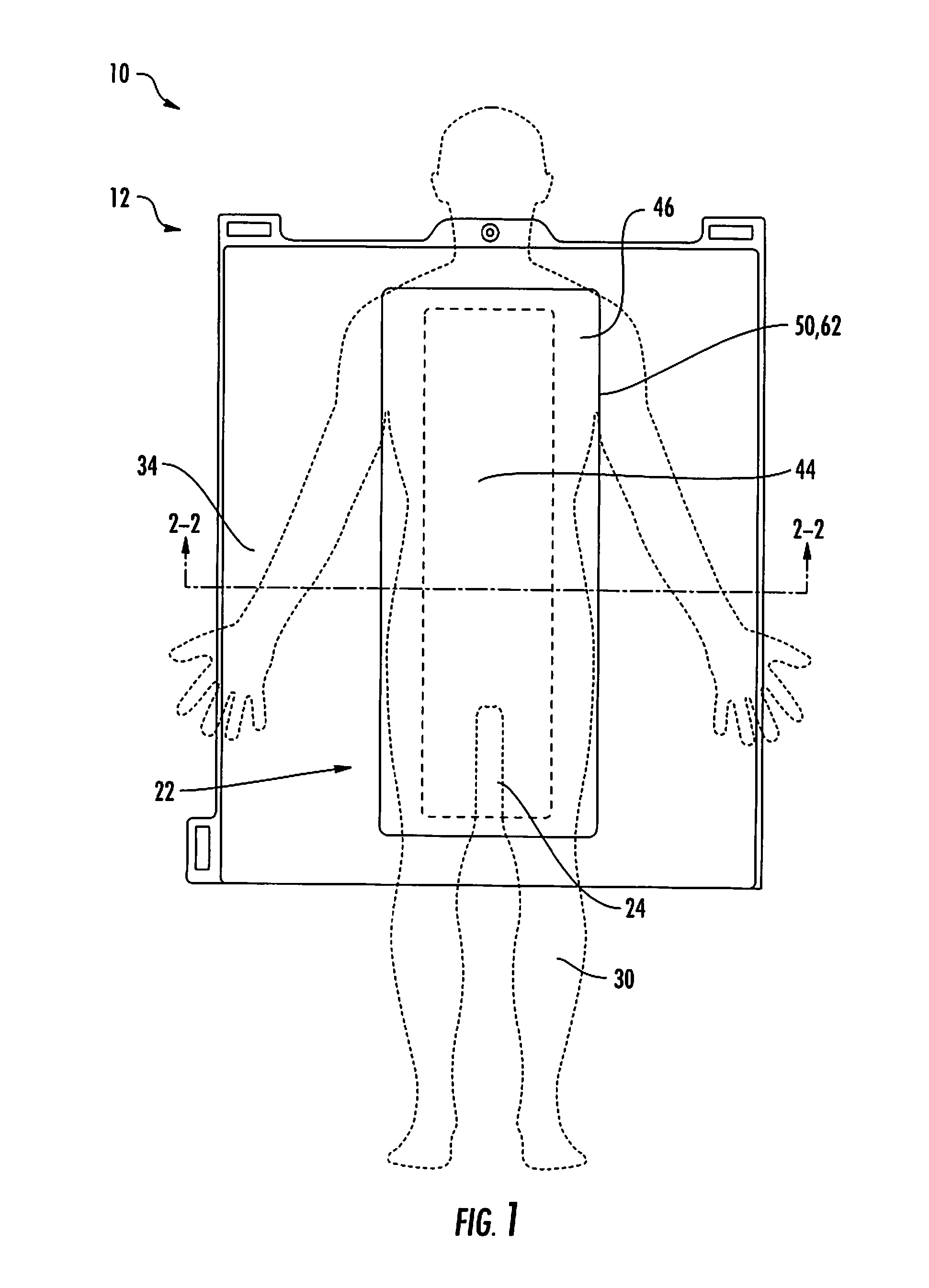 Radiotherapy patient immobilization device and method