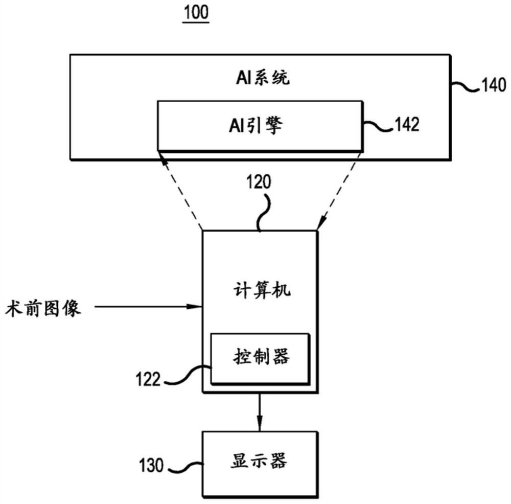 Interventional procedure optimization