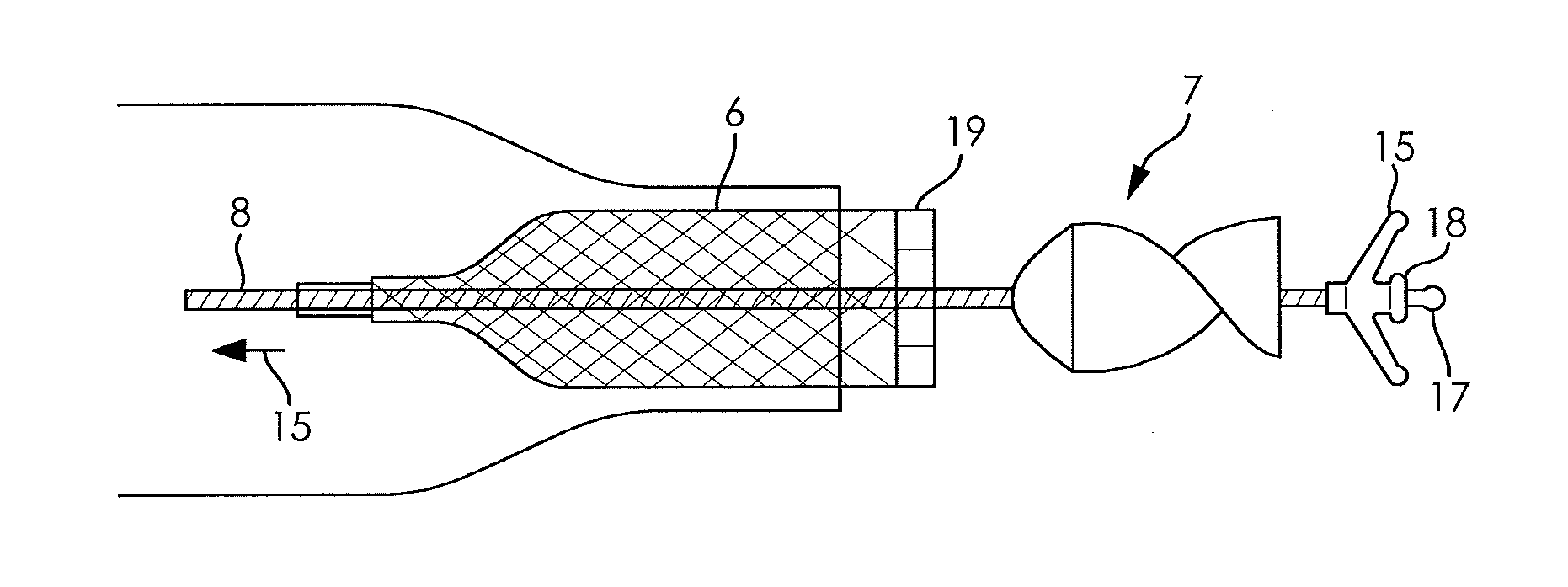 Fluid pump changeable in diameter, in particular for medical application