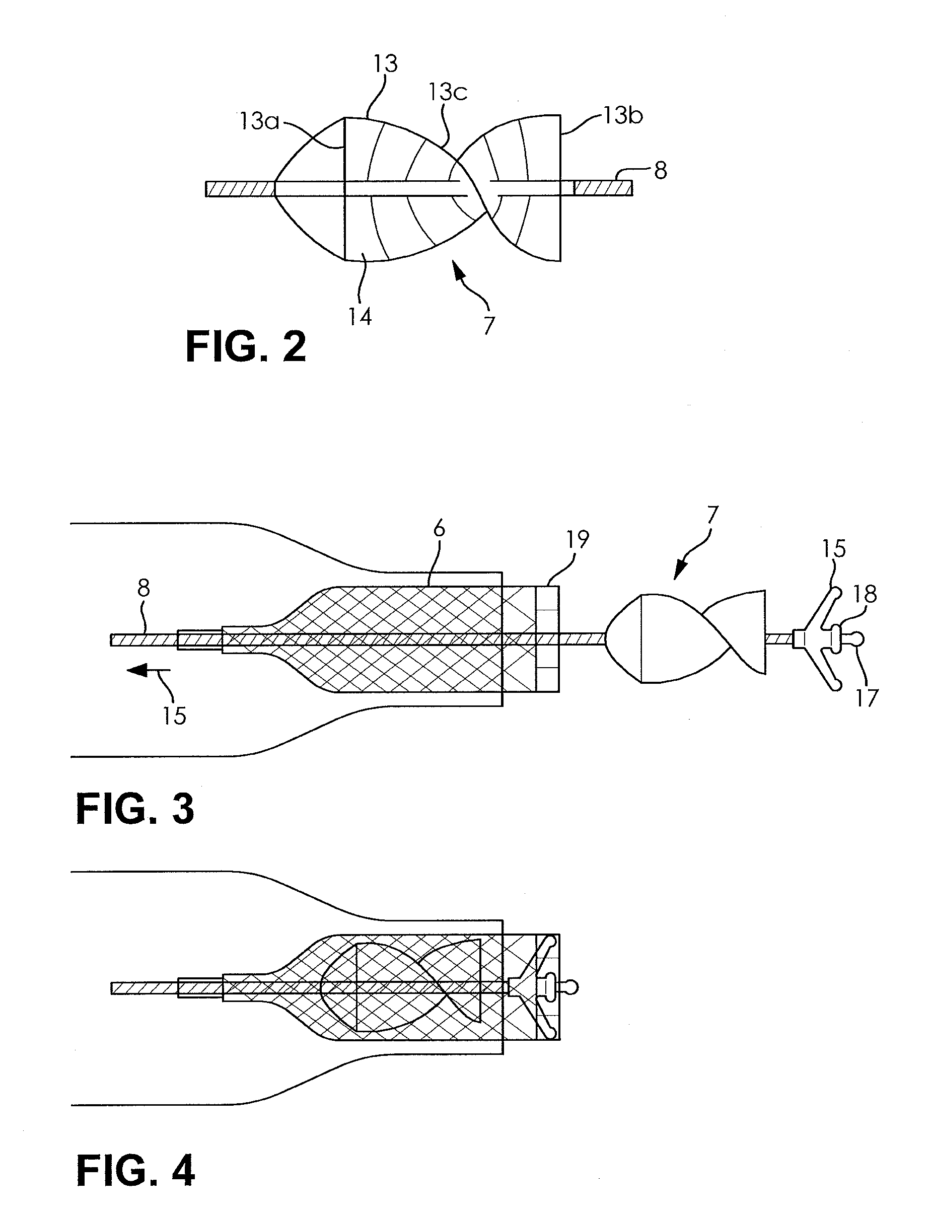 Fluid pump changeable in diameter, in particular for medical application