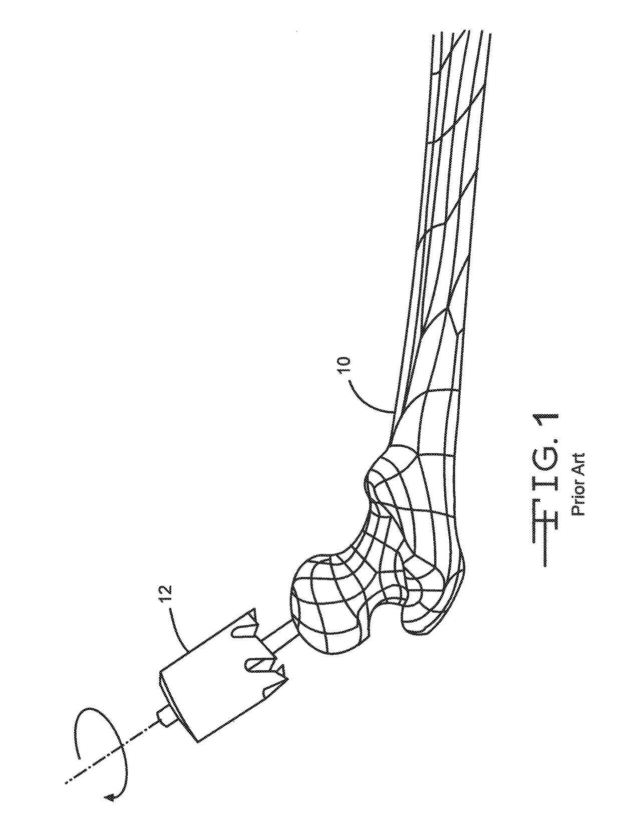 Instrument for reshaping the head of a femur