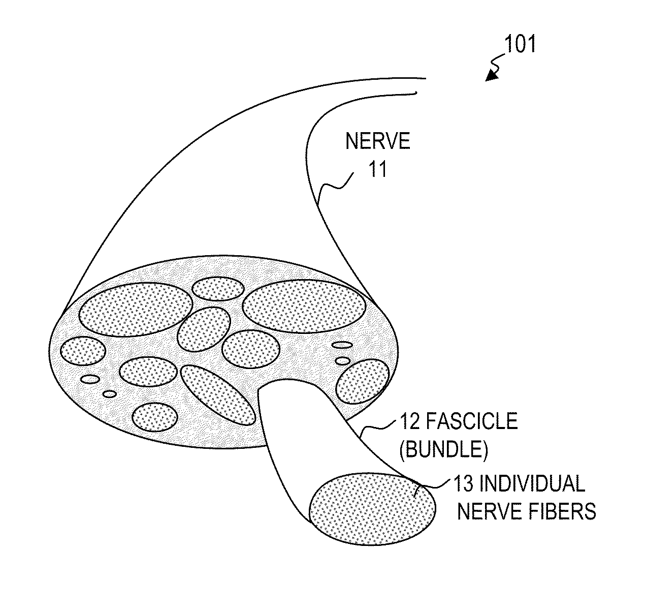 Nerve stimulator and method using simultaneous electrical and optical signals