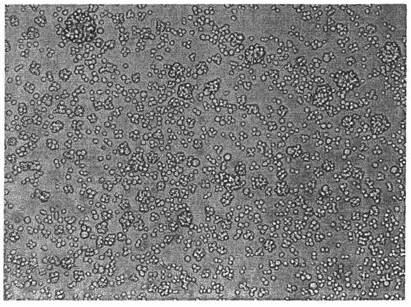 Blood serum-free culture medium for supporting suspension culture of CHO cells with large scale and high density