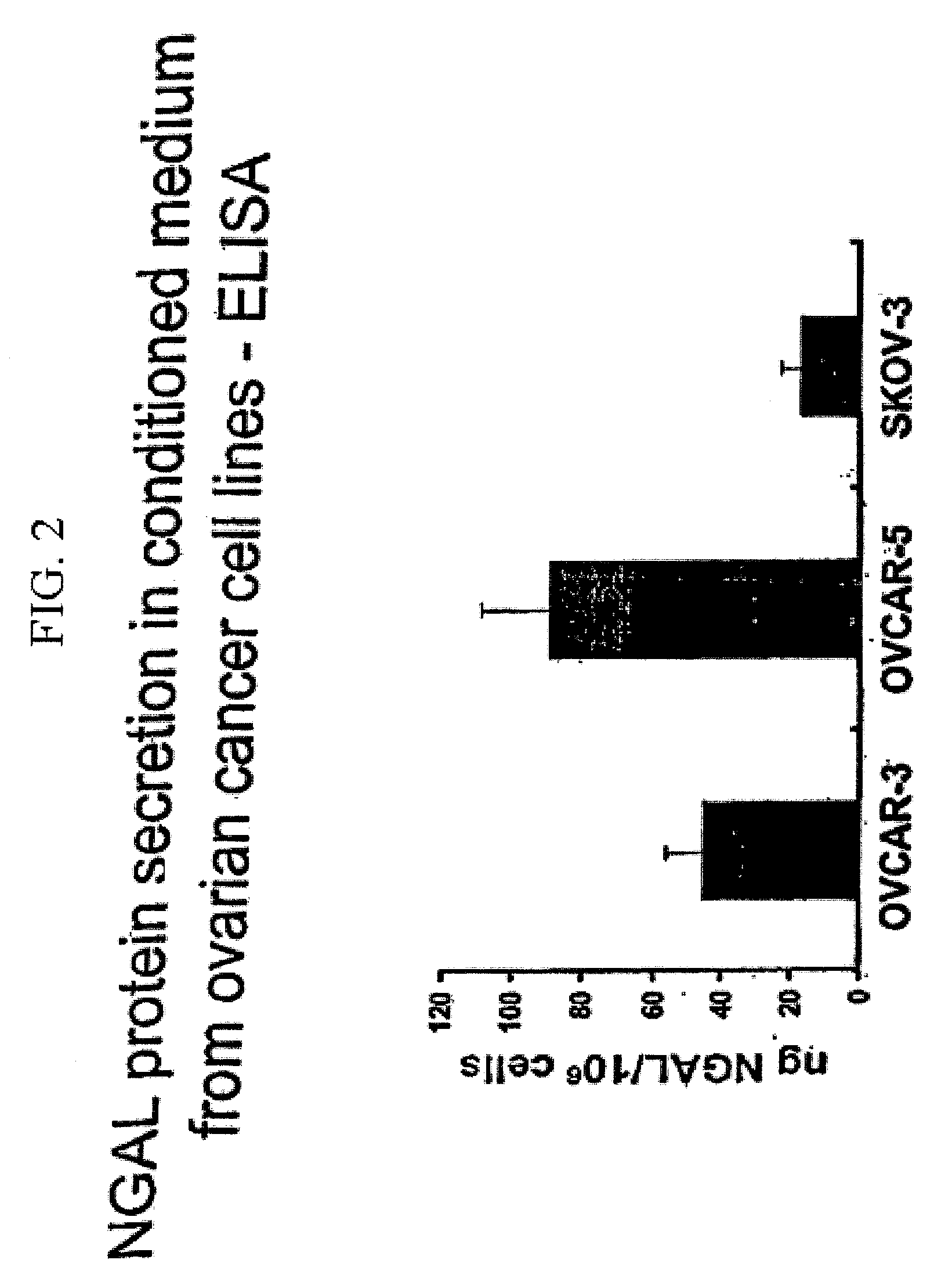 Free ngal as a biomarker for cancer