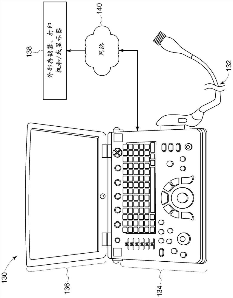 Method and system for managing image quality utilizing a generative model