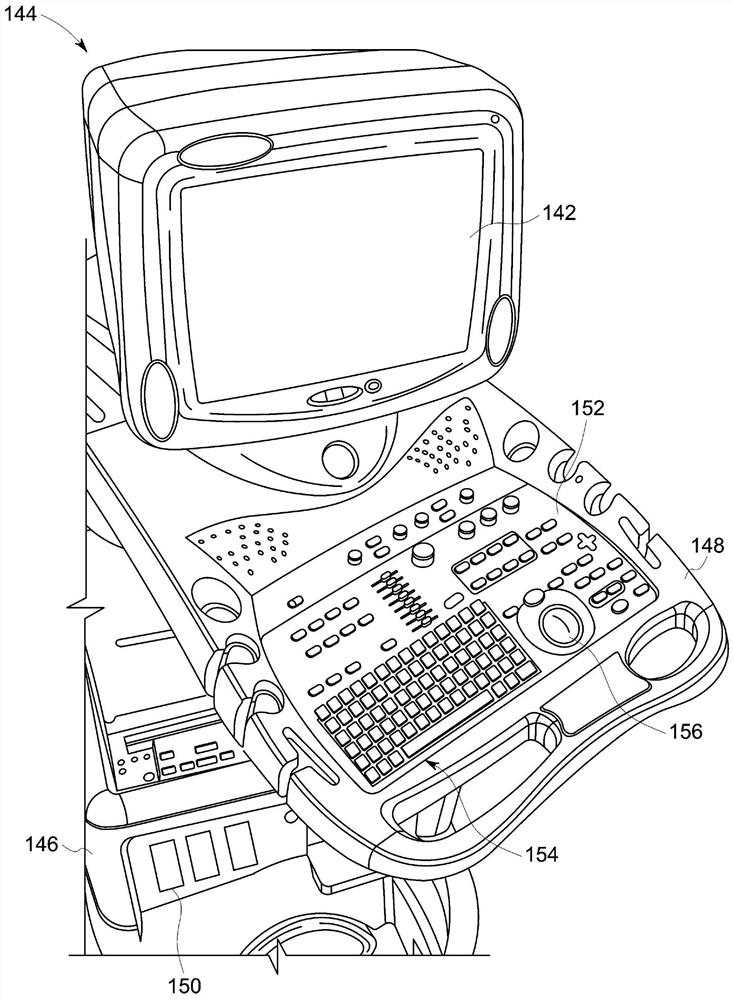 Method and system for managing image quality utilizing a generative model