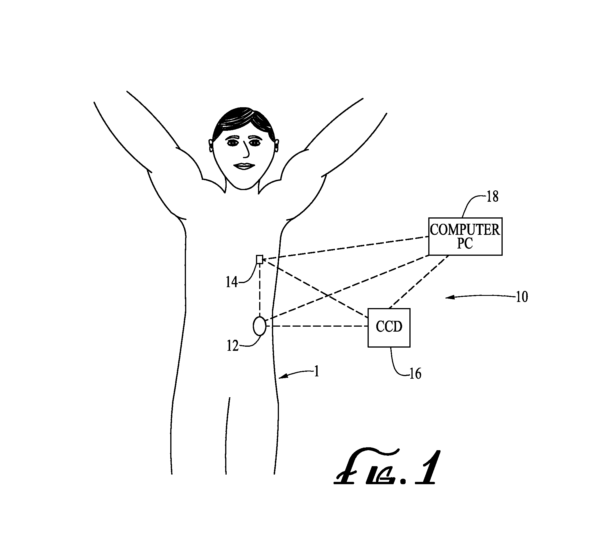 Infusion medium delivery device and method with drive device for driving plunger in reservoir