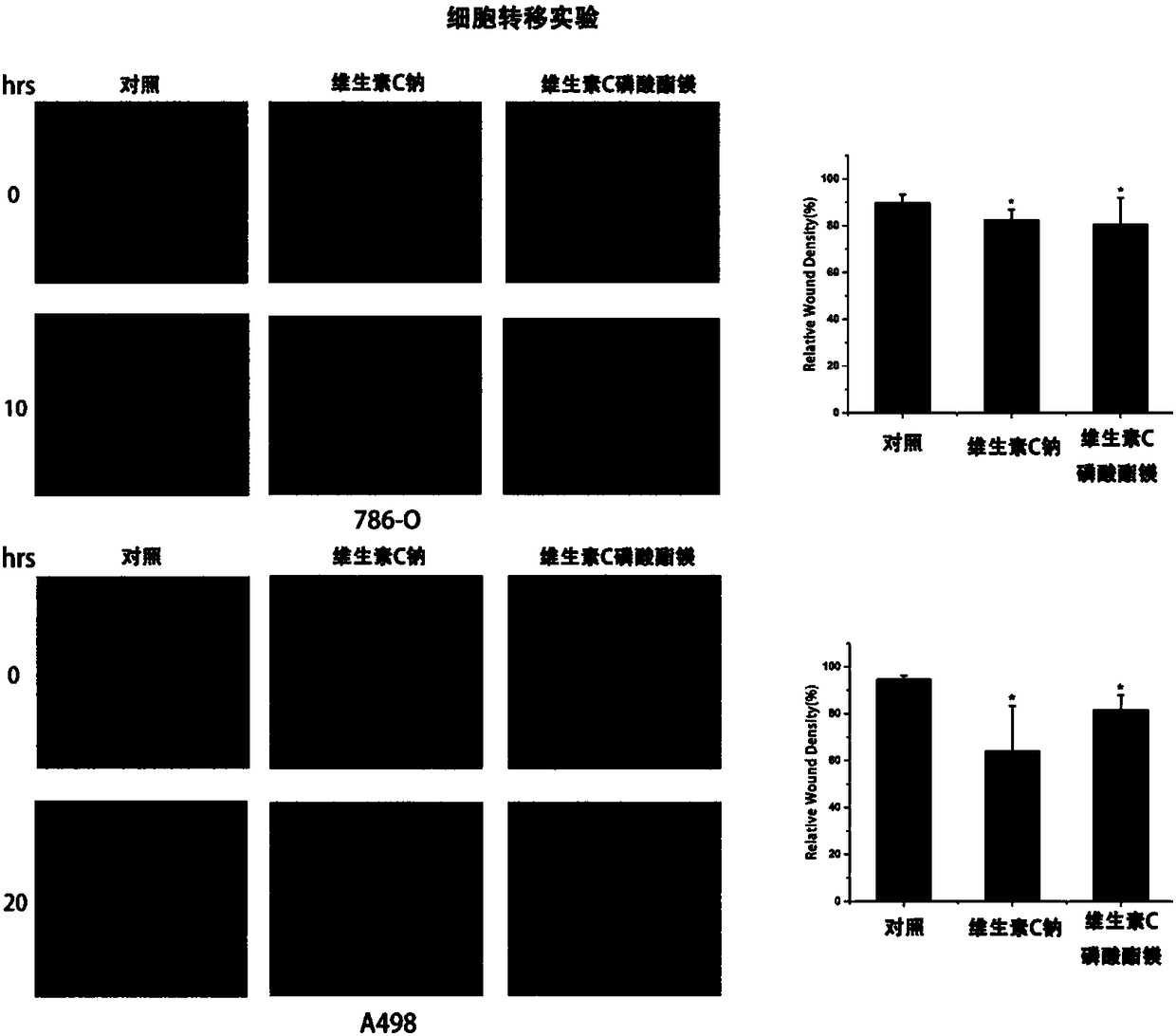 Applications of vitamin C derivatives in antitumor products