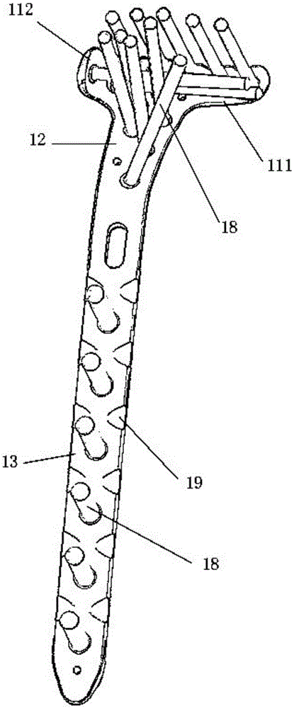 Proximal tibia fracture plate system