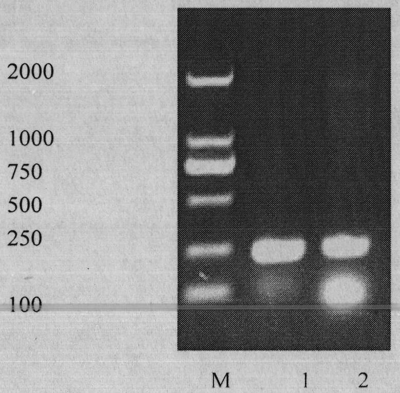 Toxoplasma circulating antigen double antibody sandwich ELISA (Enzyme-Linked Immuno Sorbent Assay) detection method