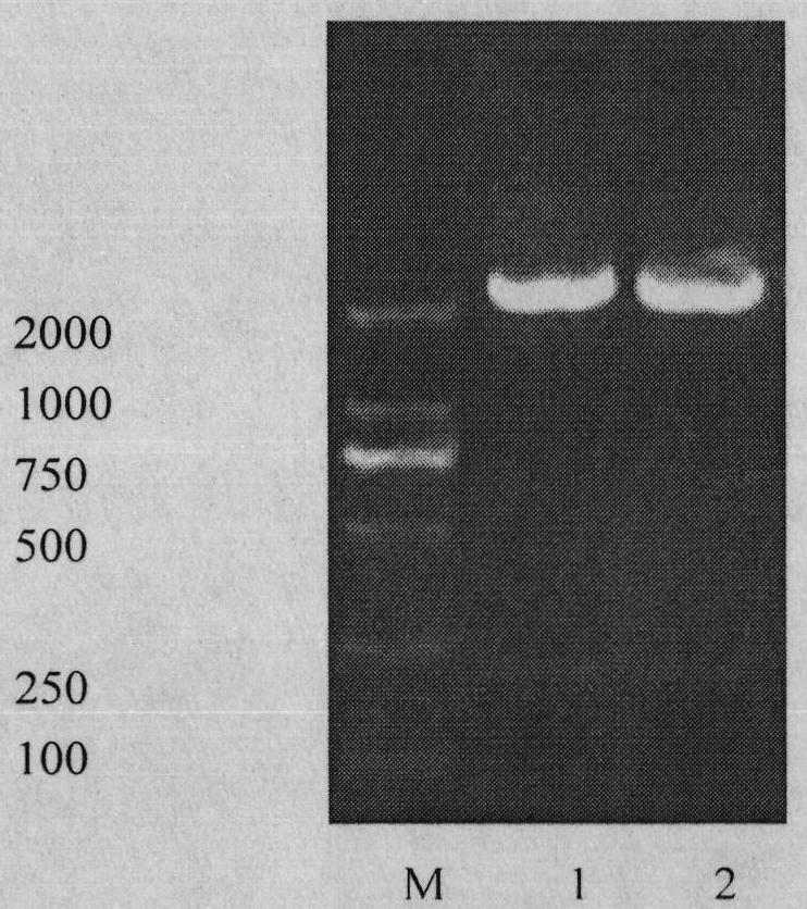 Toxoplasma circulating antigen double antibody sandwich ELISA (Enzyme-Linked Immuno Sorbent Assay) detection method