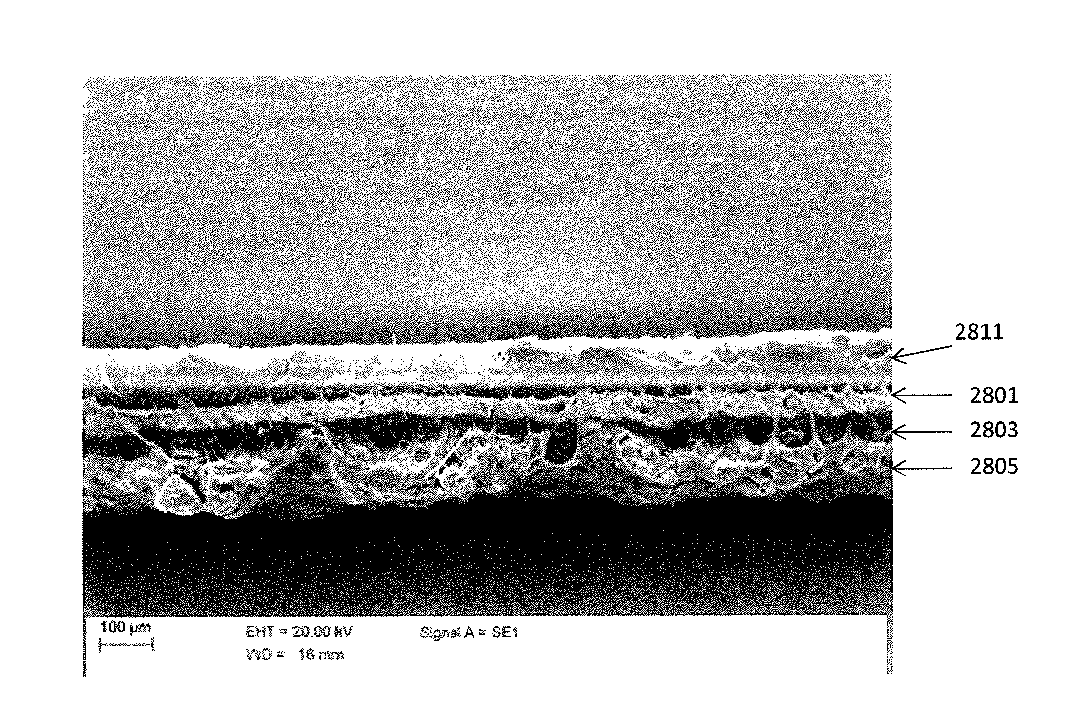 Compression garments having stretchable and conductive ink