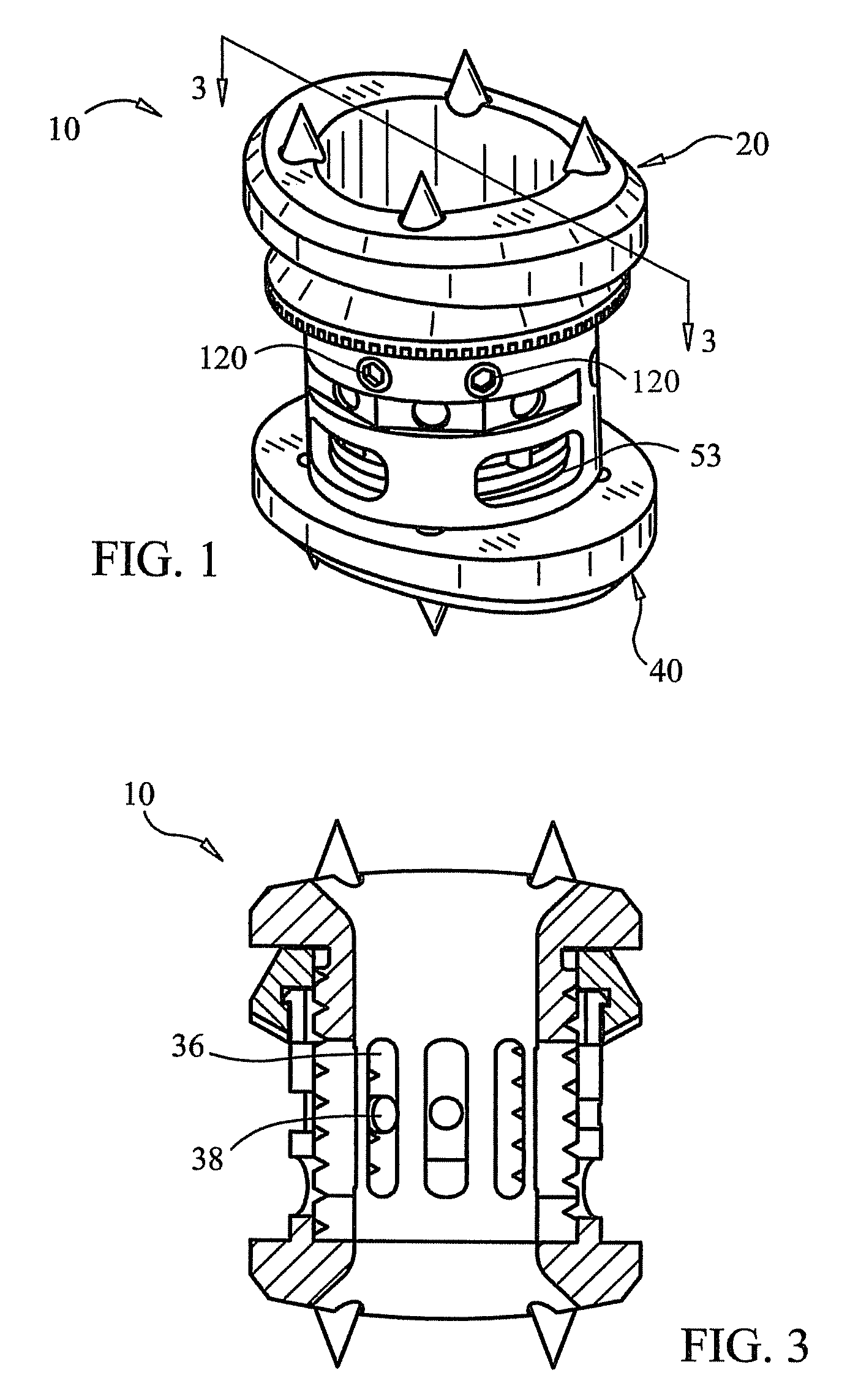 Expandable vertebral prosthesis