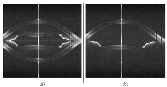 Double-channel full-range complex-spectral-domain optical coherence tomographic system