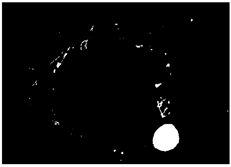 Fluorescent staining solution of detecting fungi