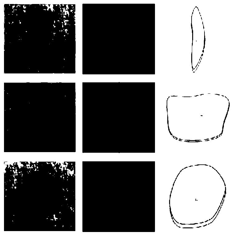 Preparation method of 3D printed wound customized adhesive bandage