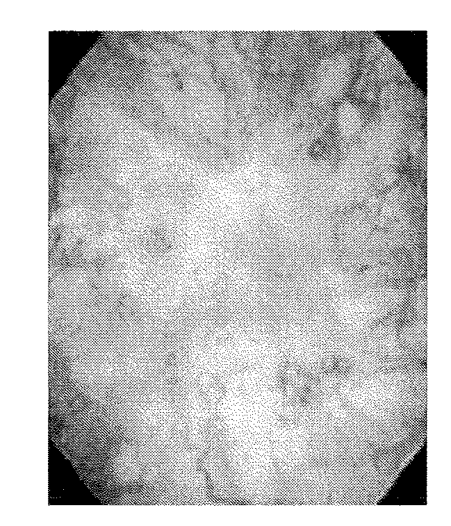 Method of diagnosing a lower urinary tract disorder