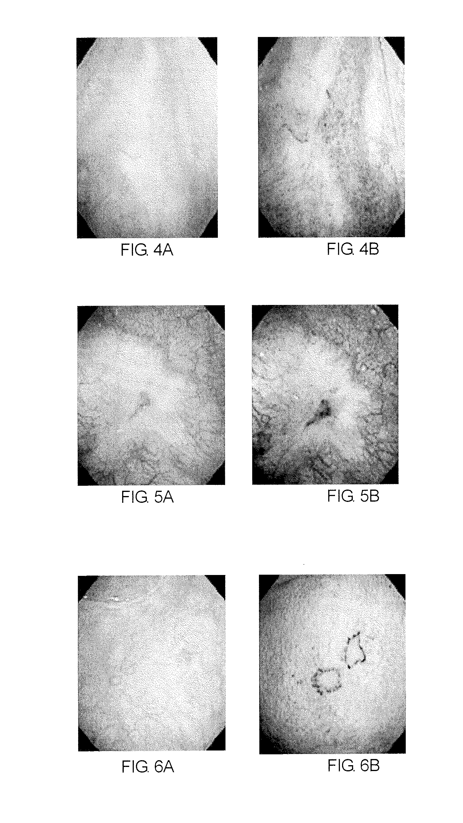 Method of diagnosing a lower urinary tract disorder