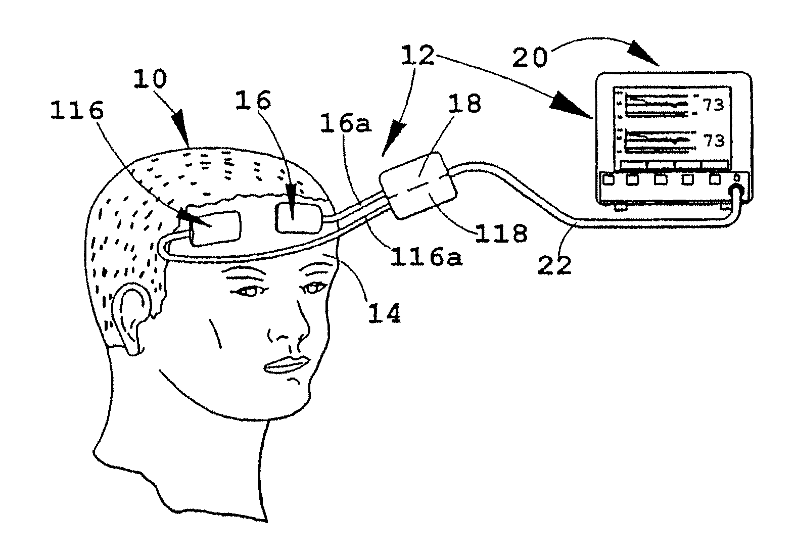 Multi-channel non-invasive tissue oximeter