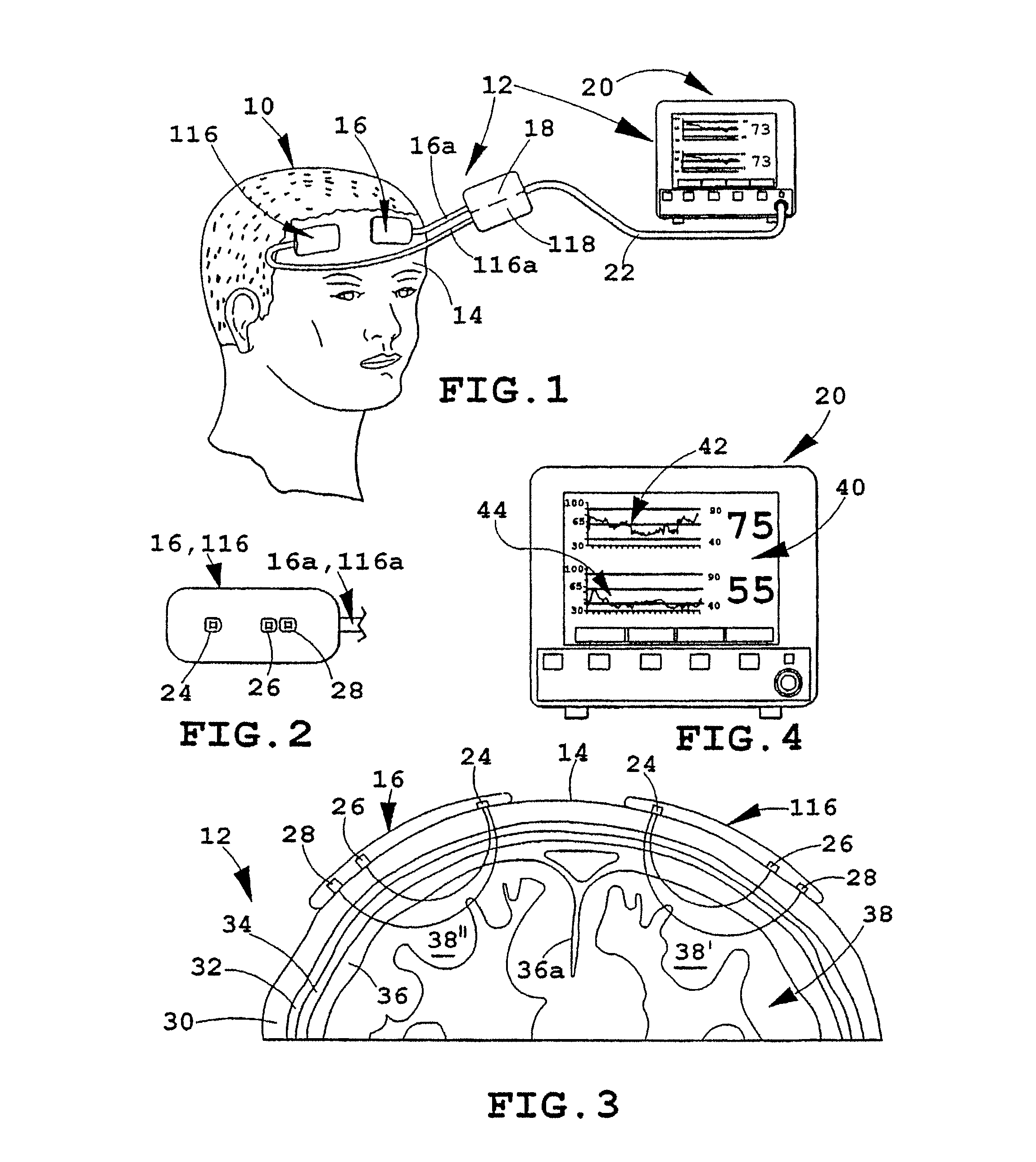 Multi-channel non-invasive tissue oximeter