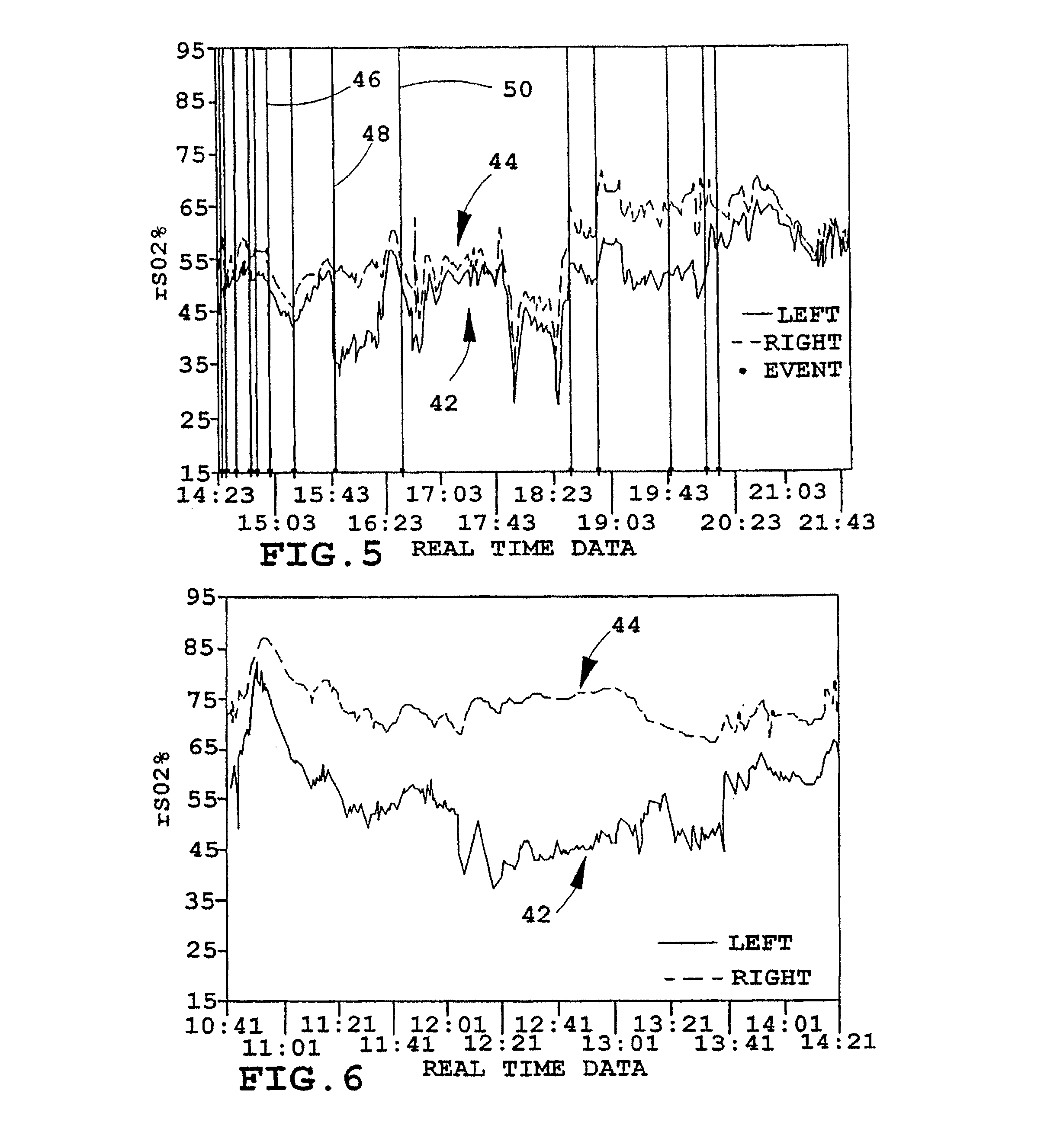 Multi-channel non-invasive tissue oximeter