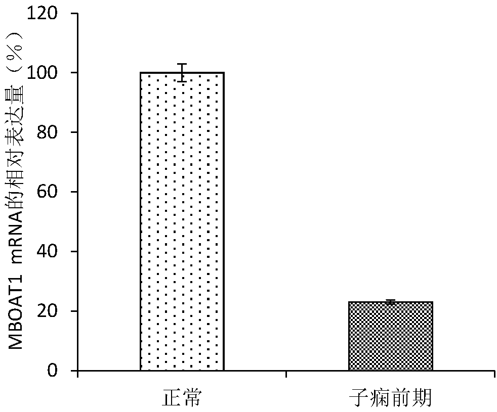 Application of MBOAT1 gene in preeclampsia