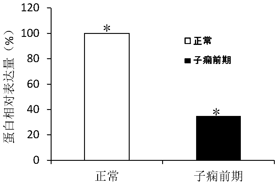 Application of MBOAT1 gene in preeclampsia