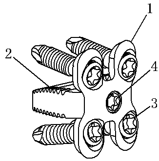 Embedded anterior cervical compression fusion fixing device