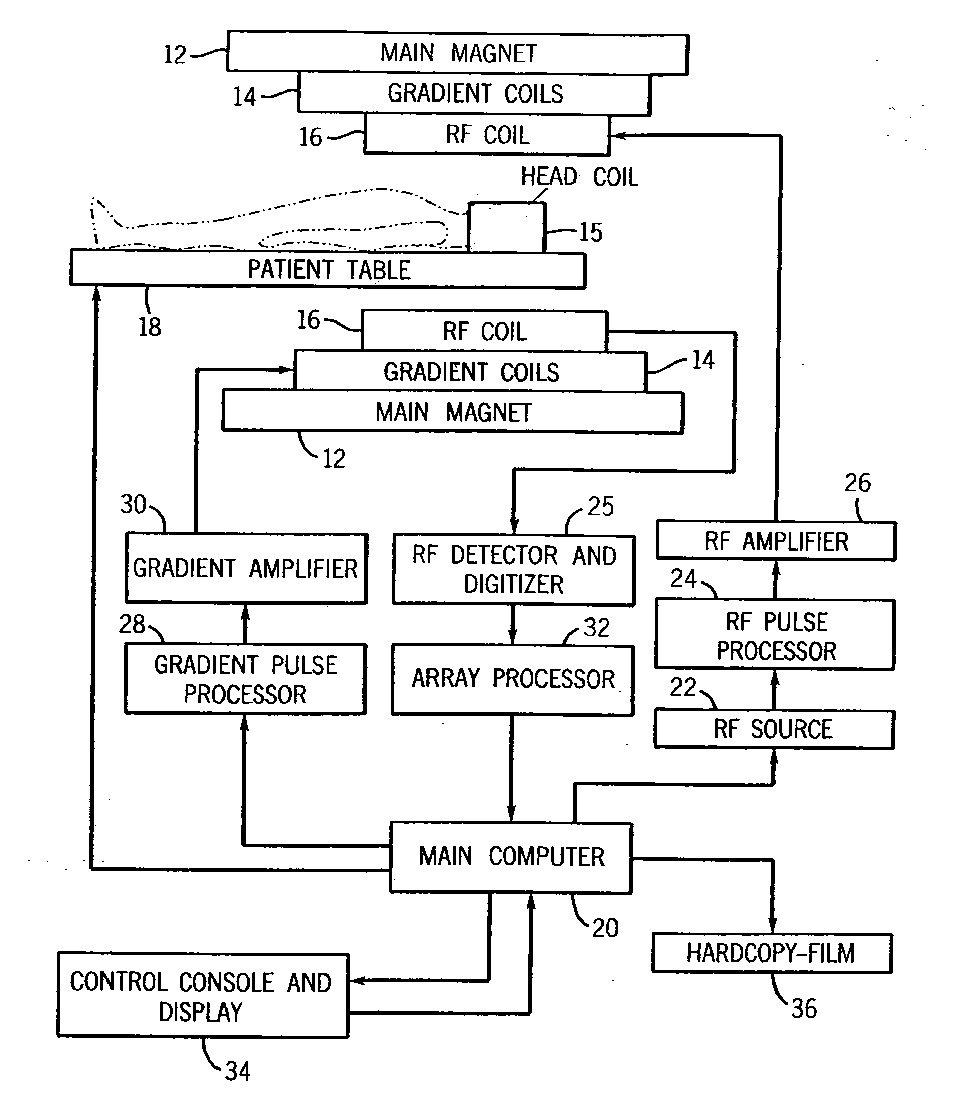 System for detecting symptoms, determining staging and gauging drug efficacy in cases of Alzheimer's disease