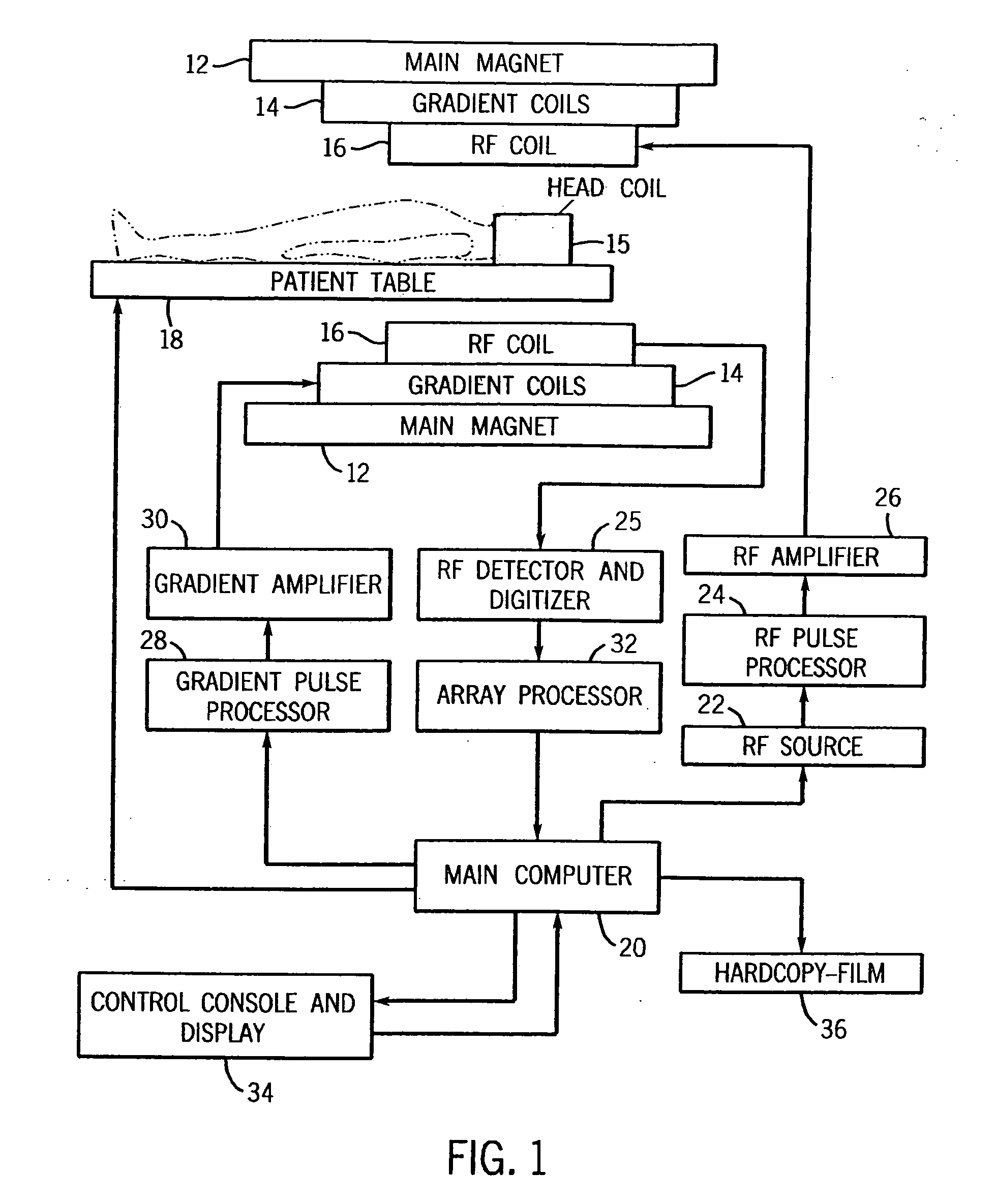 System for detecting symptoms, determining staging and gauging drug efficacy in cases of Alzheimer's disease