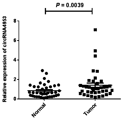 Early CRC (Colorectal Cancer) diagnostic marker circ4953 and application thereof