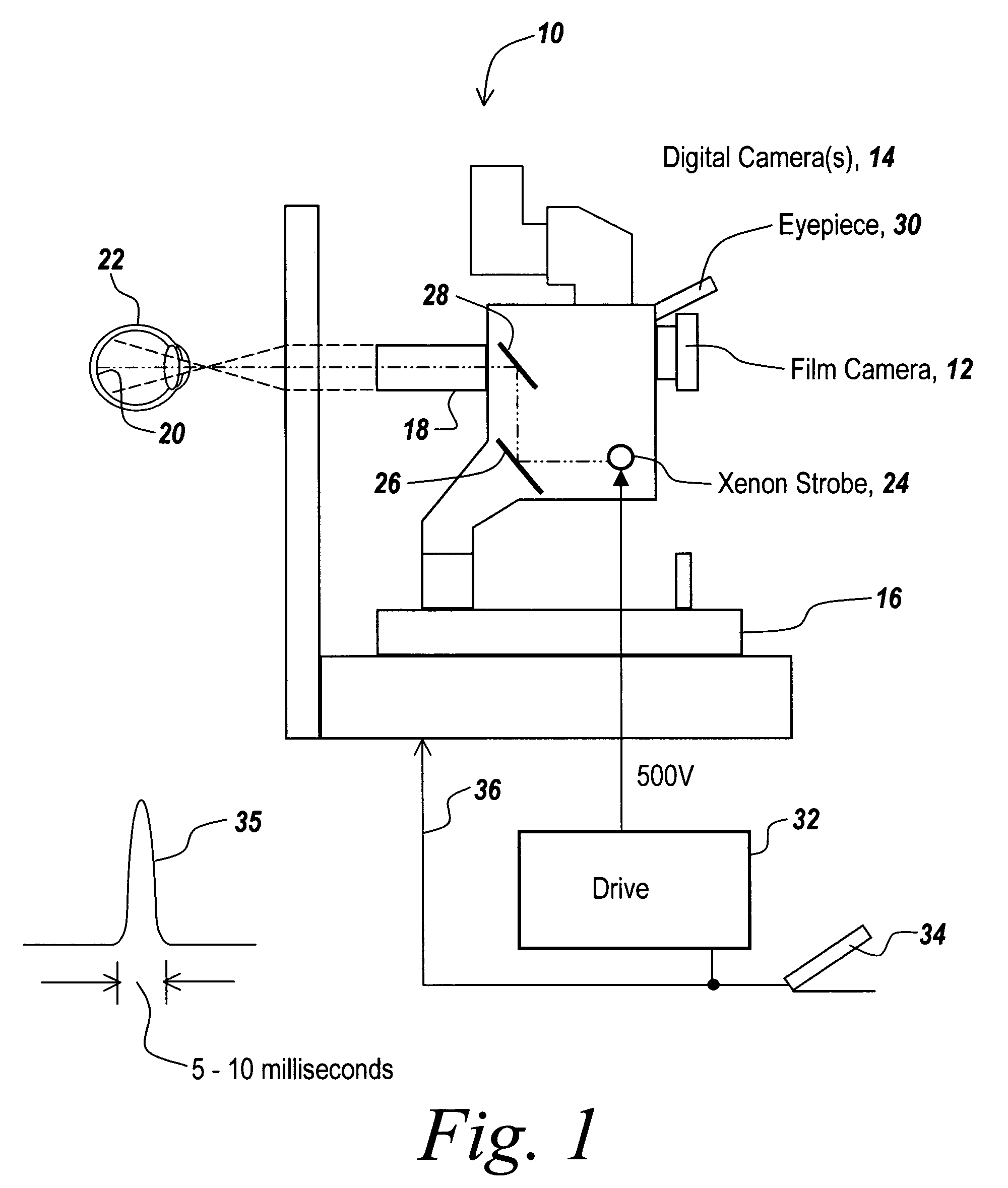 Grayscale redistribution system to improve retinal imaging by reducing the effect of a highly reflective optic nerve