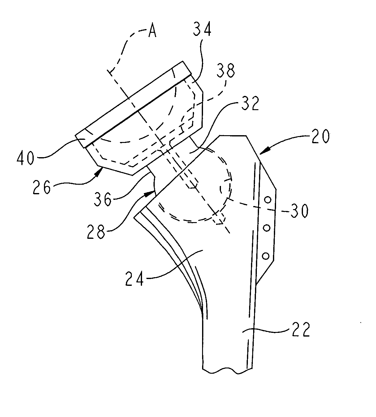 Reverse-type humeral prosthesis