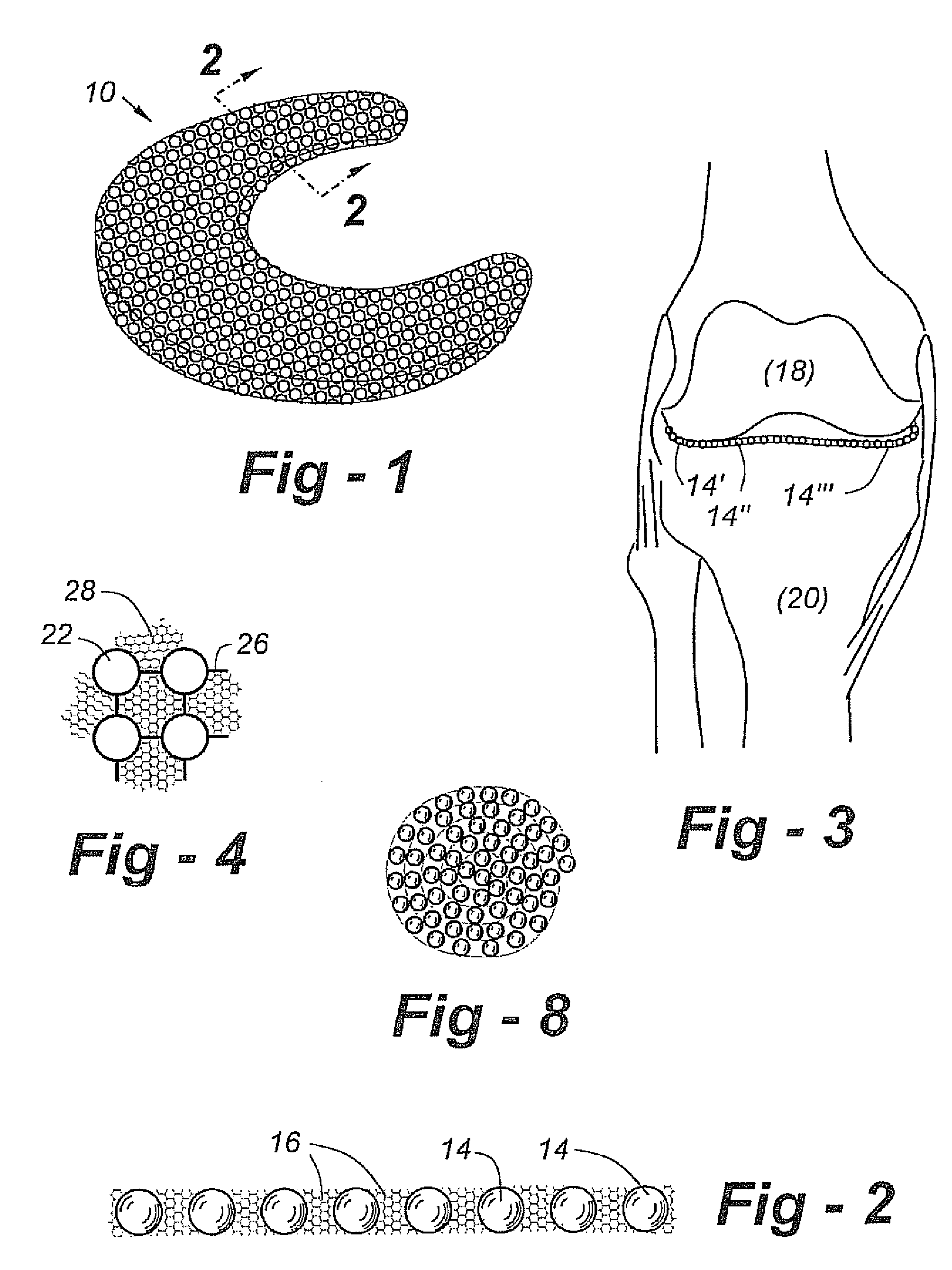 Prosthesis for replacement of cartilage