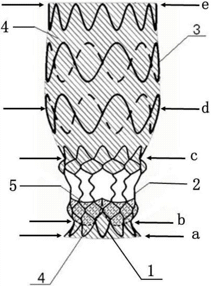 Ascending aorta and aortic valve integrated intravascular stent