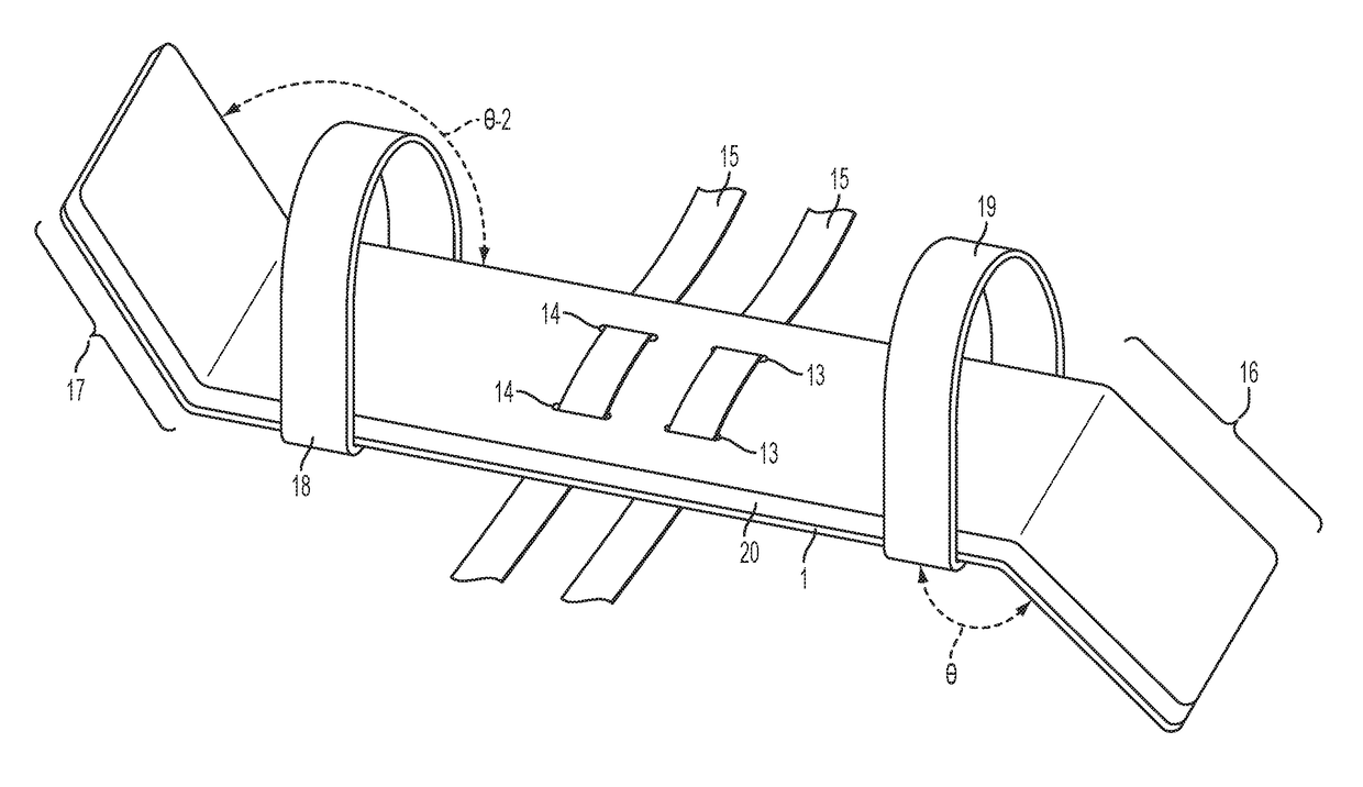 Arm restraint for iv site stability