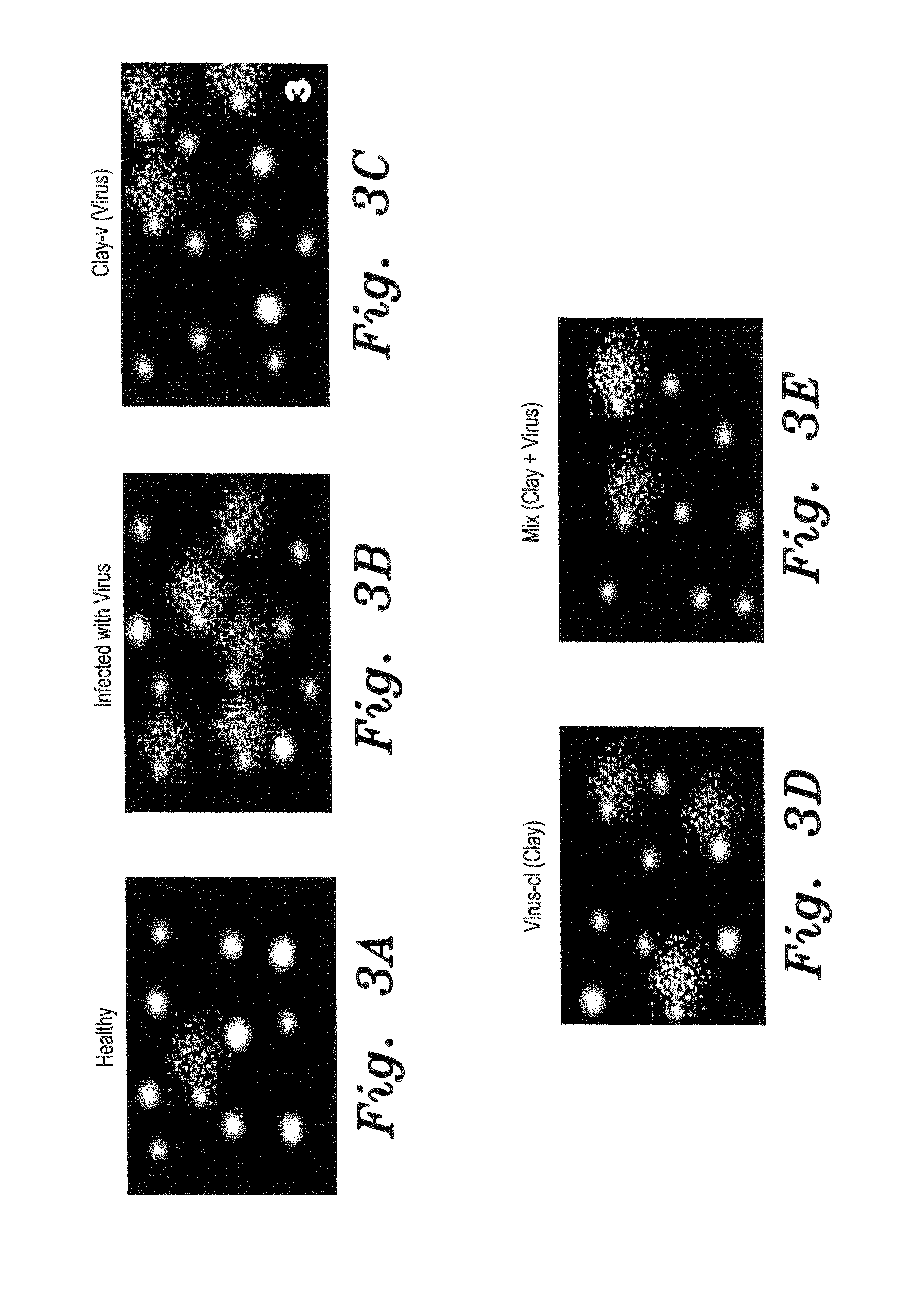 Method of using a clay suspension to prevent viral and phytoplasma diseases in plants