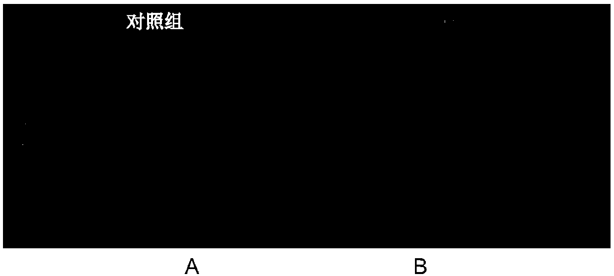 Application of lysophosphatidic acid