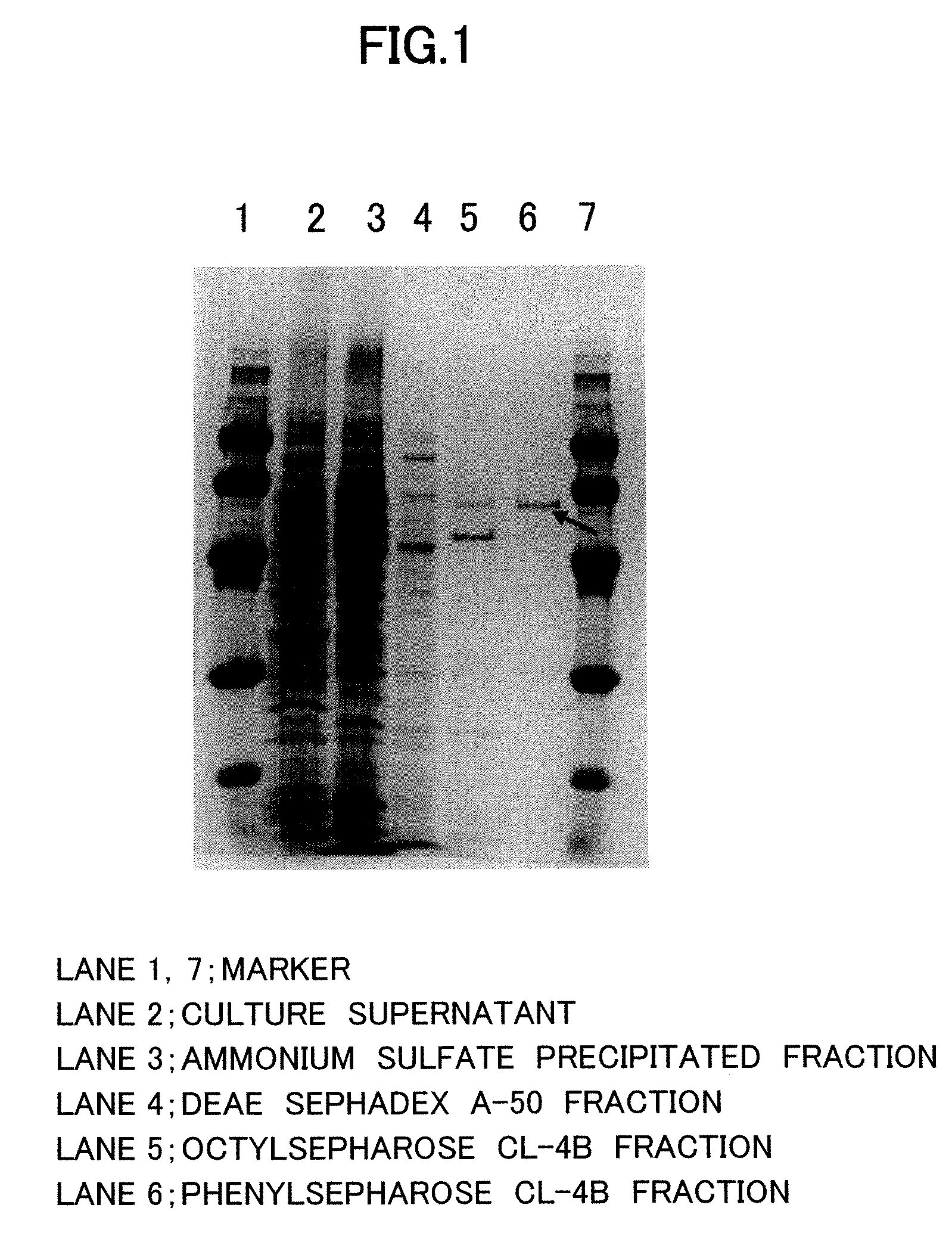 Nε-acyl-L-lysine-specific aminoacylase