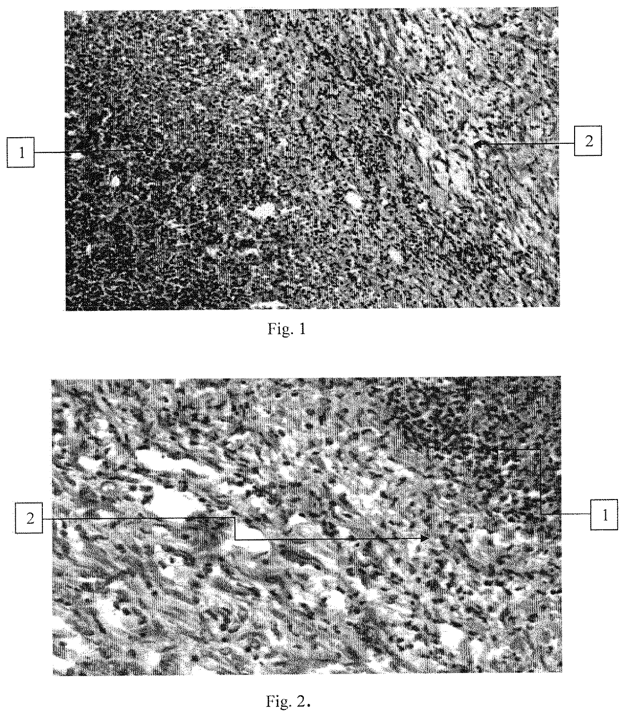 Antiseptic composition comprising polyvinylpyrrolidone and unithiol and use of the composition