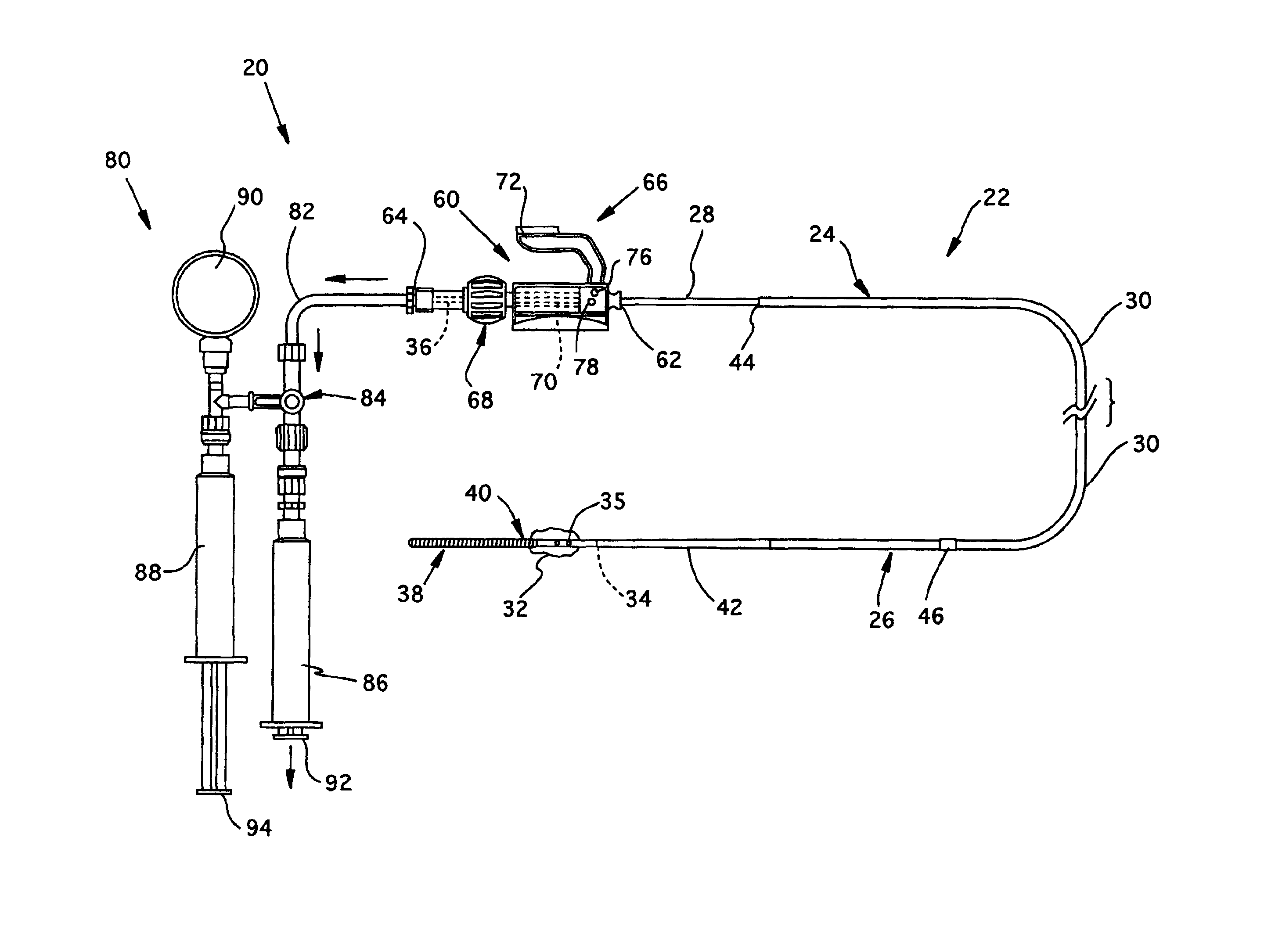 Guidewire occlusion system utilizing repeatably inflatable gas-filled occlusive device