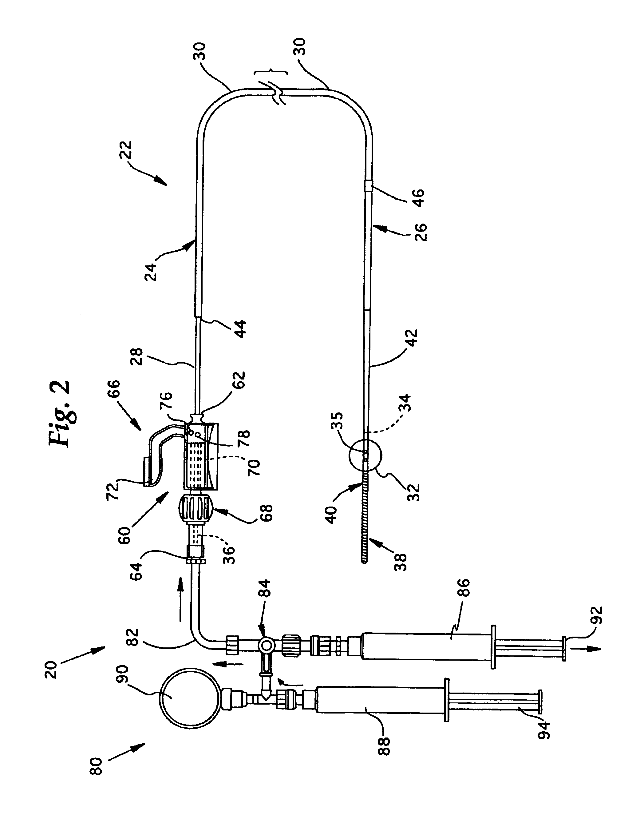 Guidewire occlusion system utilizing repeatably inflatable gas-filled occlusive device