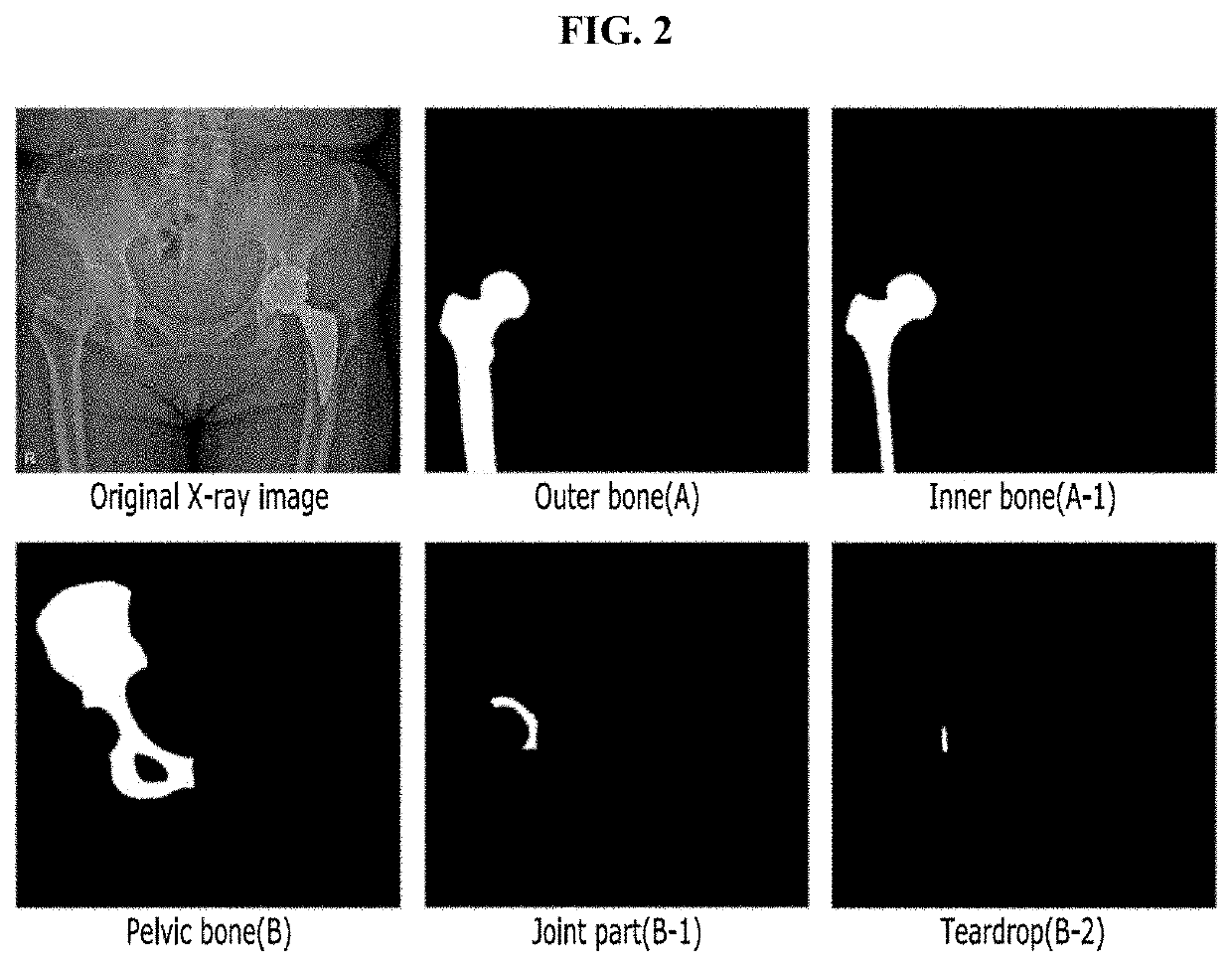 Medical image processing method and device using machine learning