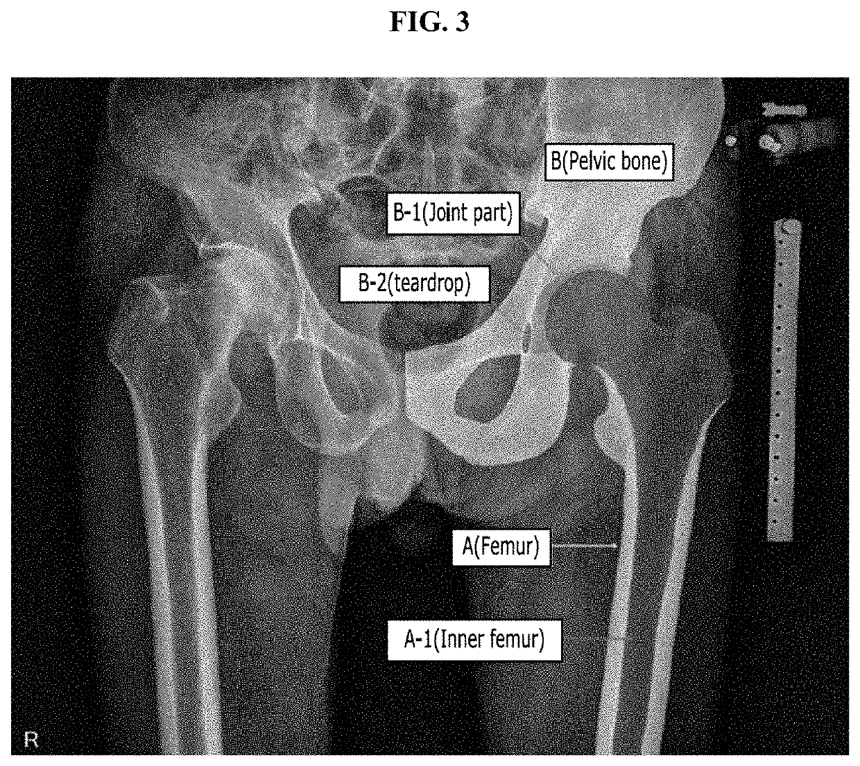 Medical image processing method and device using machine learning