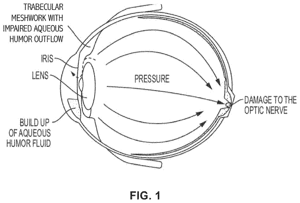 Methods, systems, and compositions for maintaining functioning drainage blebs associated with minimally invasive micro sclerostomy