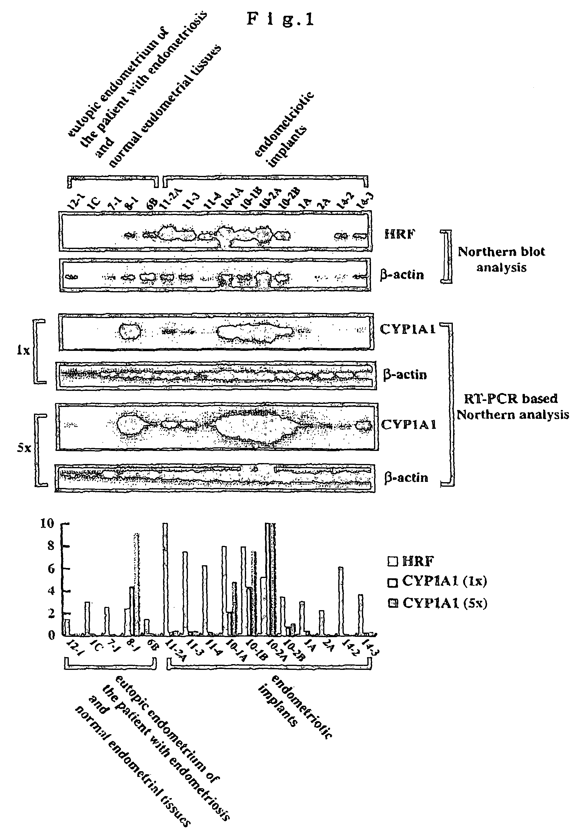 Method of diagnosing disease relating to endometriosis