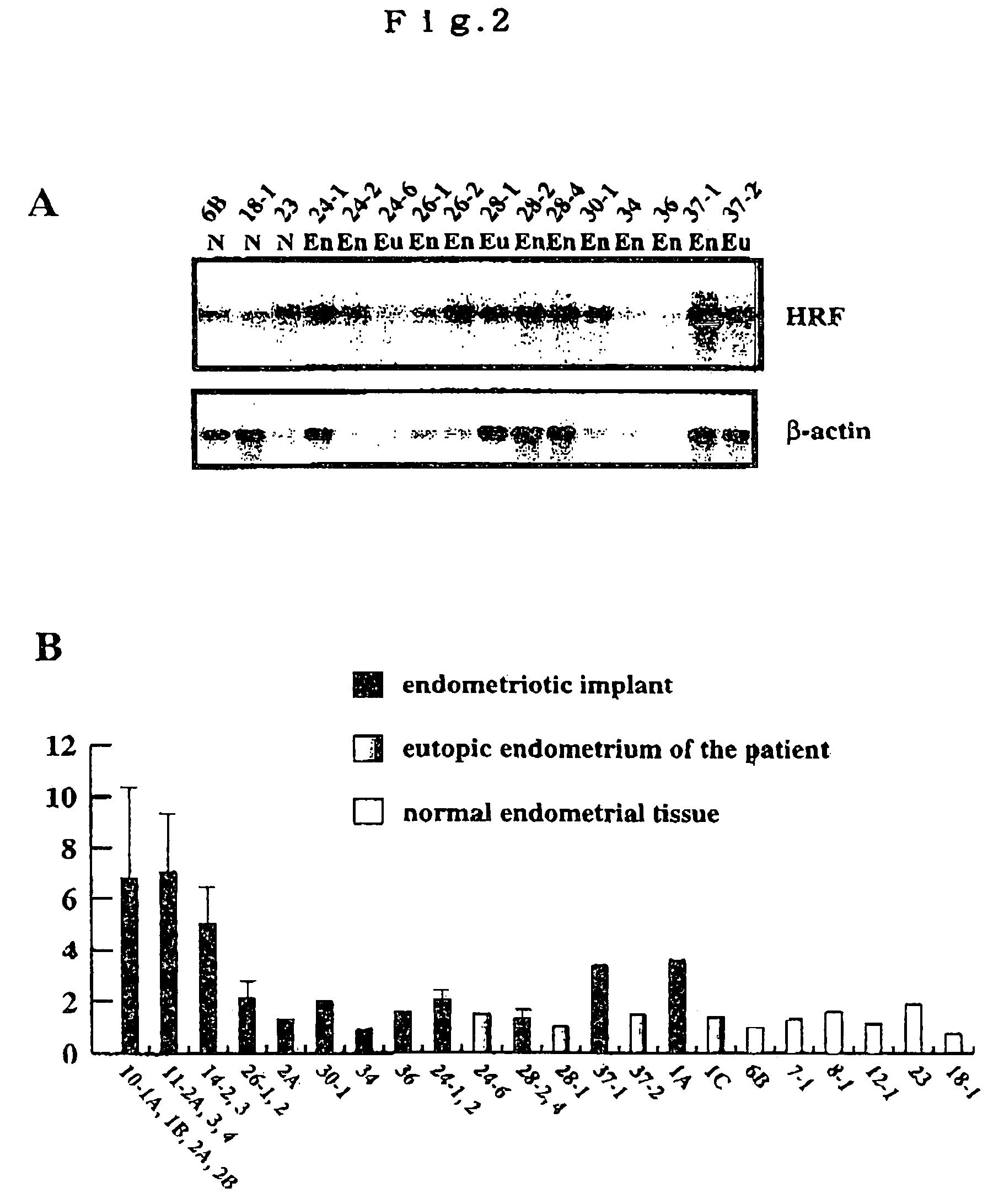 Method of diagnosing disease relating to endometriosis