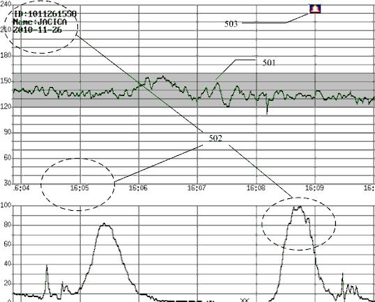 Method and device for printing fetal heart rate curve