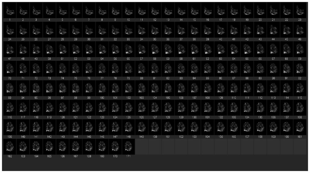 Tissue and organ three-dimensional imaging and analysis method based on continuous slicing, multicolor fluorescence and three-dimensional reconstruction