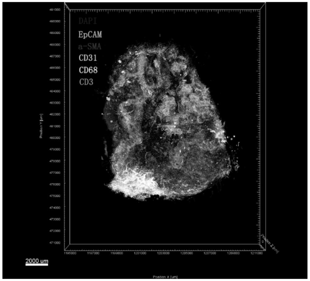 Tissue and organ three-dimensional imaging and analysis method based on continuous slicing, multicolor fluorescence and three-dimensional reconstruction